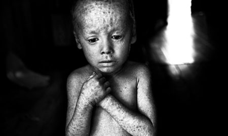 LuganoPhotoDays 2019 - "The Human Cost of Agrotoxins" di Pablo Ernesto Piovano